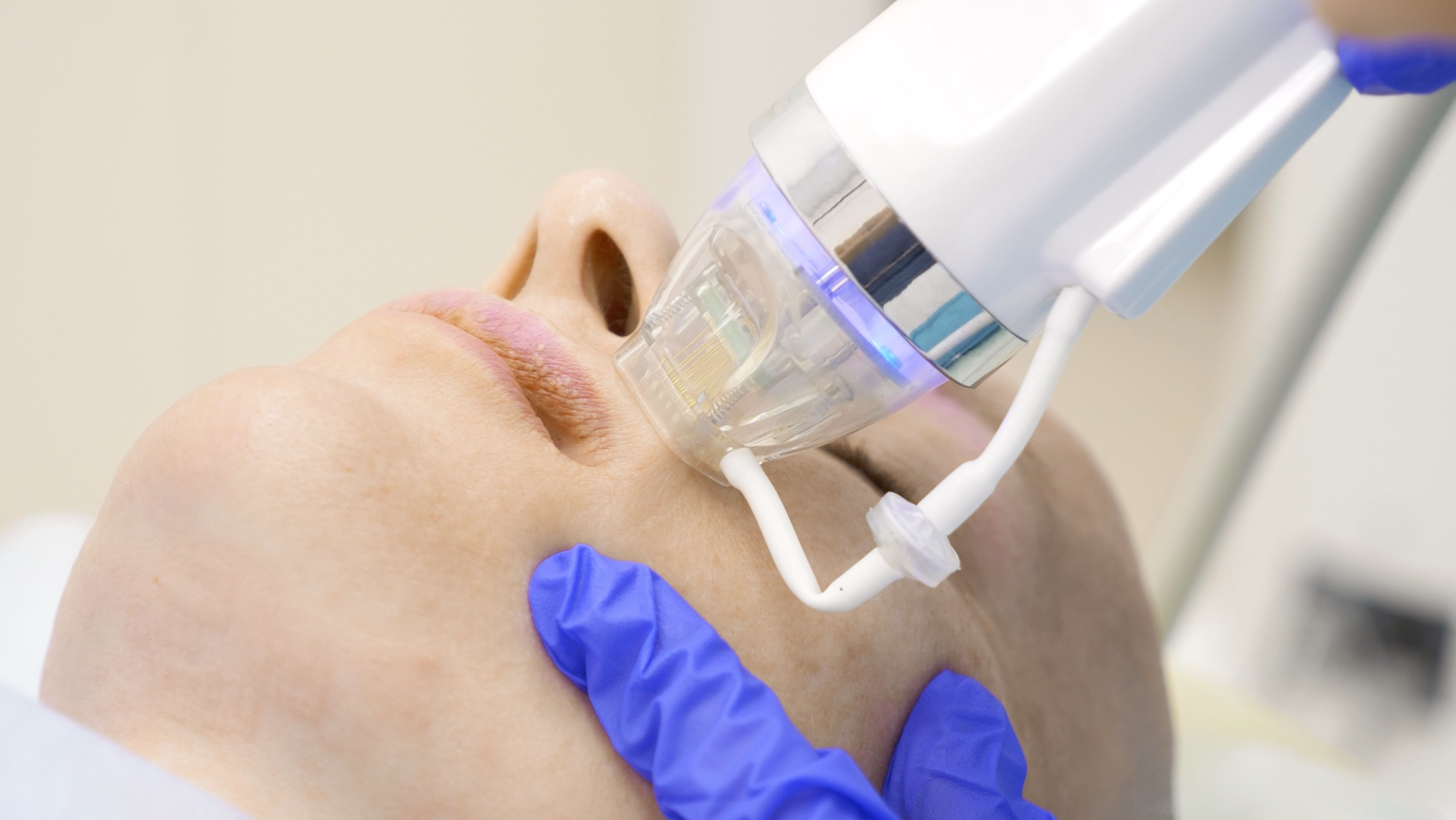 PRE-Care Oil + Activator, Esse Aesthetic – Profesjonell forberedelse før estetisk behandling